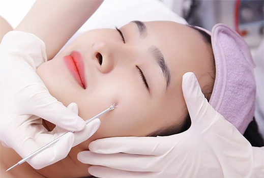 Liệu Trình Điều Trị Mụn Cơ Bản Tại Thu Hà Spa
